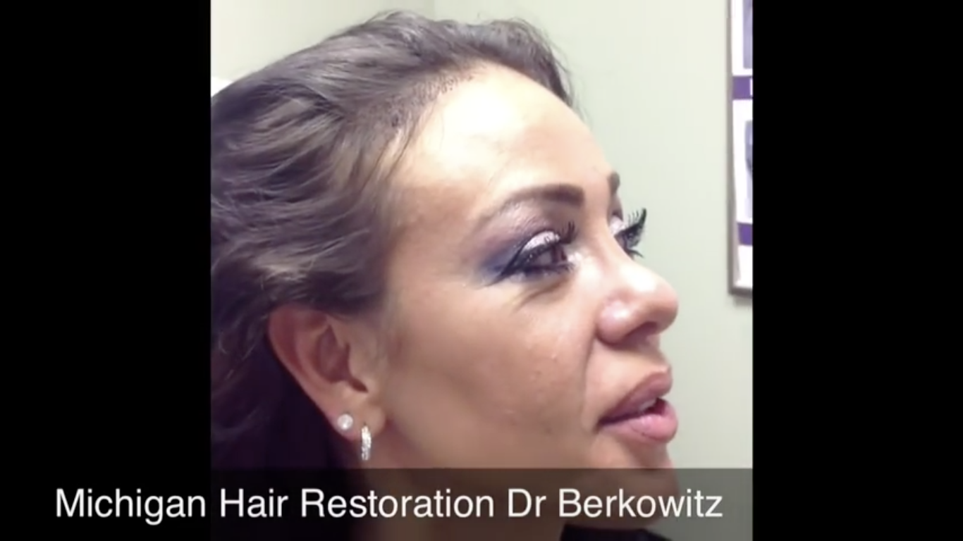 Hair Restoration Videos