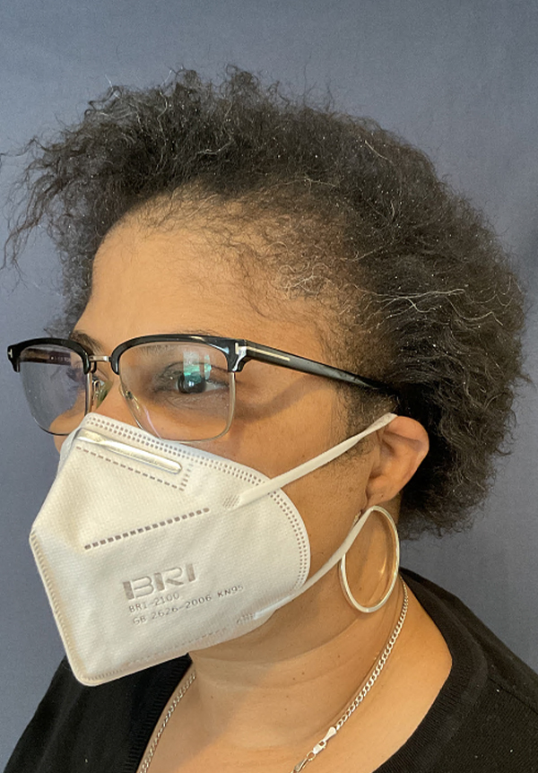 For Women Before and After | Michigan Hair Restoration