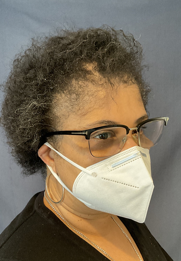 For Women Before and After | Michigan Hair Restoration